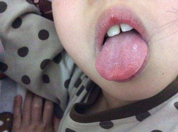 孩子磨牙<strong></p>
<p>响币</strong>，为什么白天不响晚上“嘎吱嘎吱响”？原因简单却难治