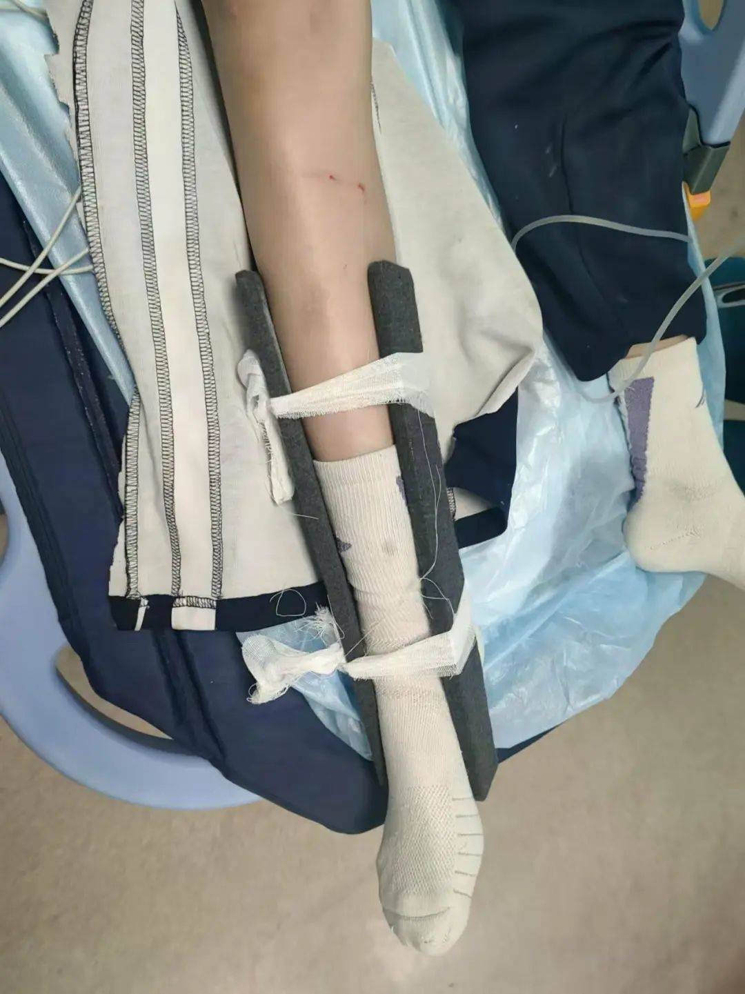 惨痛<strong></p>
<p>虚拟币横盘</strong>！一人身亡！深圳多名学生骑电动车发生意外