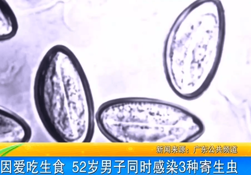 女子体内排出10米长绦虫<strong></p>
<p>区块链虚拟币交易平台官网</strong>！原是两年前旅游时吃了这种食物