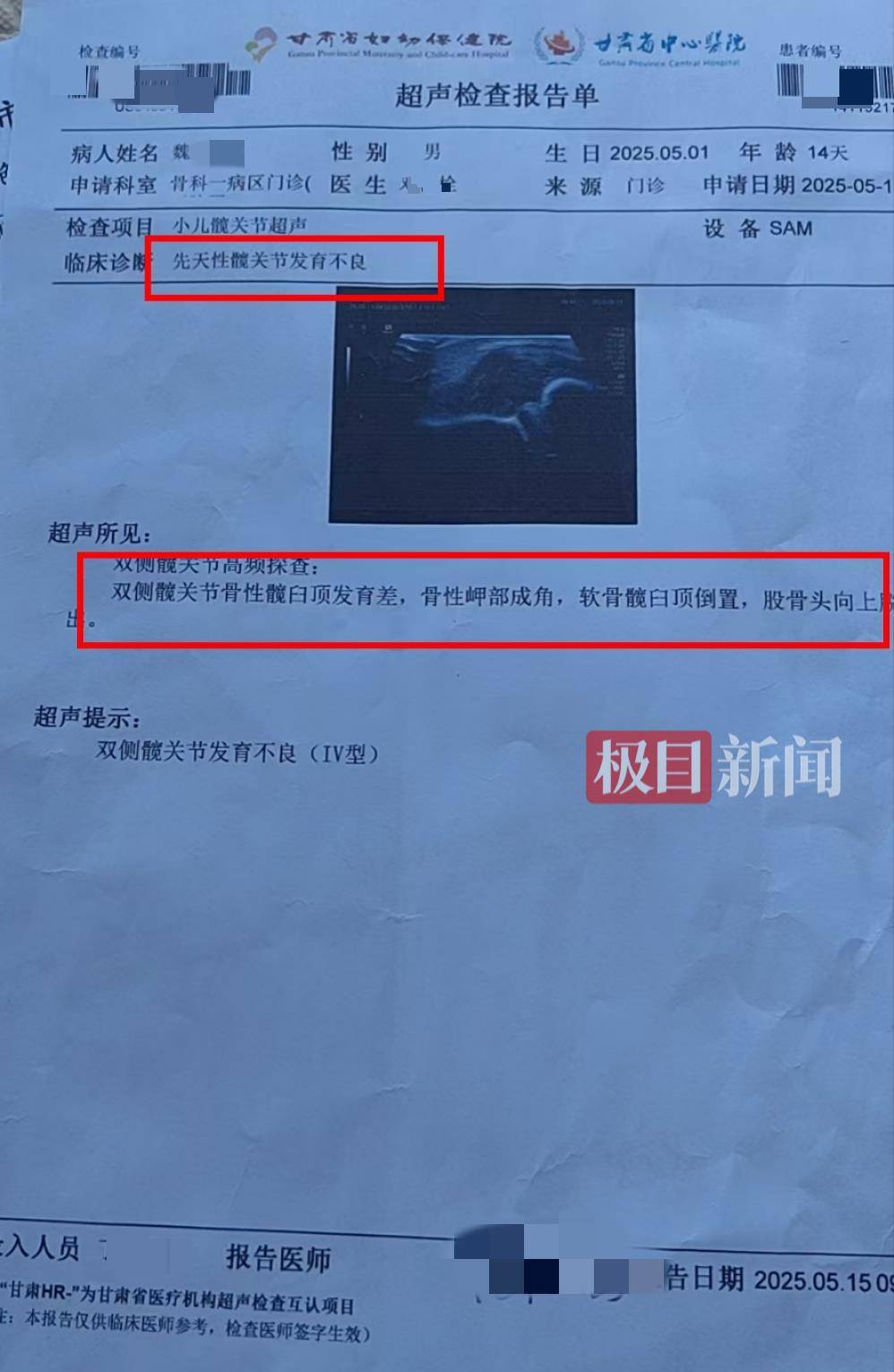 二胎出生查出先天性病症或落下残疾<strong></p>
<p>原油交易规则</strong>，残疾父母称医院产检漏检、未尽告知义务，医院及医调委回应