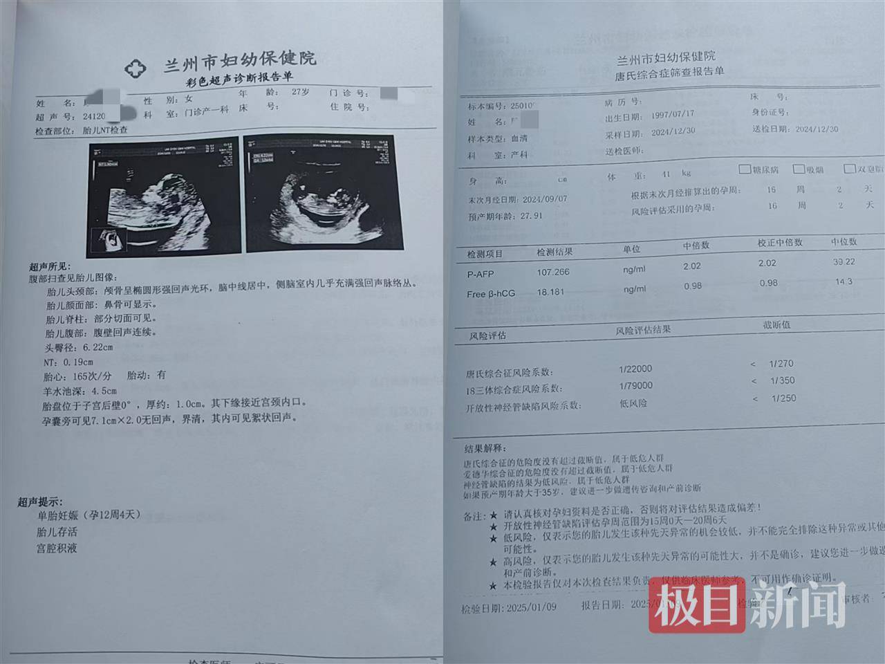 二胎出生查出先天性病症或落下残疾<strong></p>
<p>原油交易规则</strong>，残疾父母称医院产检漏检、未尽告知义务，医院及医调委回应