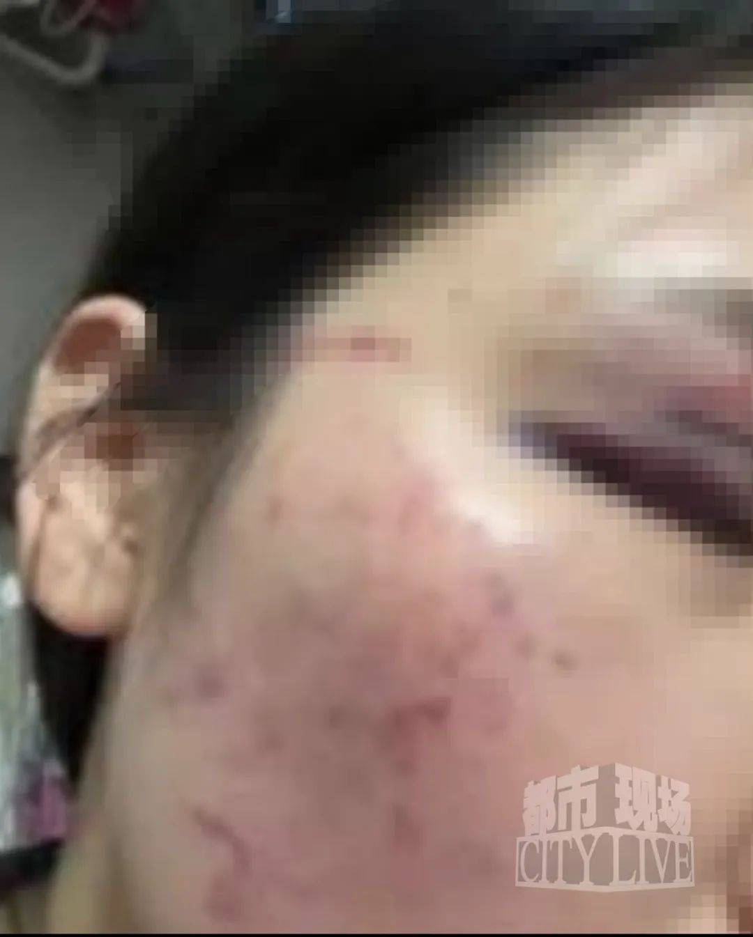 湖南衡阳29岁女子疑被男友施暴后从25楼跳下身亡 男友徐某此前还刺激说：“你放心<strong></p>
<p>挖原油</strong>，她不会去死的”