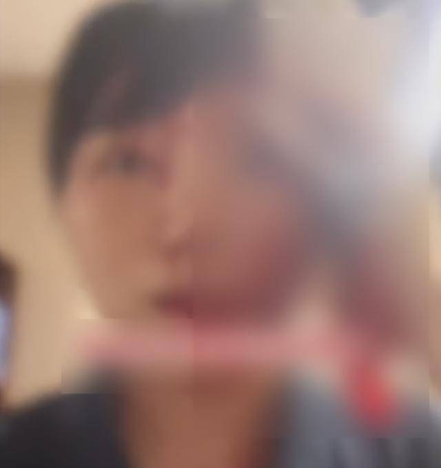 缝了20多针！女子称被不知名男同事砸头毁容<strong></p>
<p>国际原油价格表</strong>，警方介入