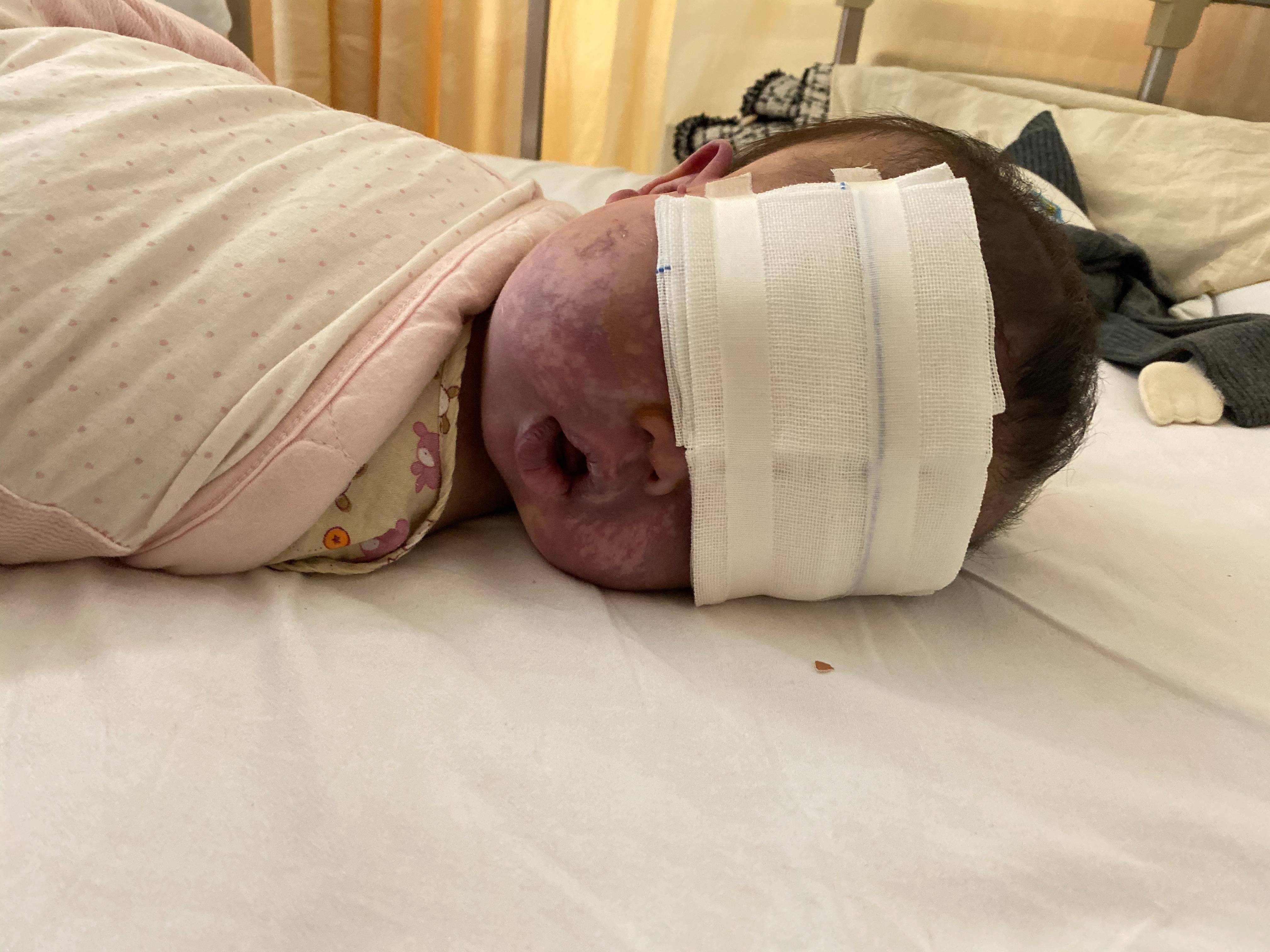 上饶6岁女童患病满身红斑<strong></p>
<p>上期原油</strong>，初上幼儿园妈妈字里行间满是担心：曾经绝望，现在能看到光