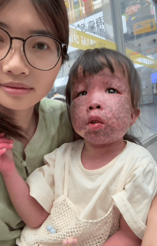 上饶6岁女童患病满身红斑<strong></p>
<p>上期原油</strong>，初上幼儿园妈妈字里行间满是担心：曾经绝望，现在能看到光