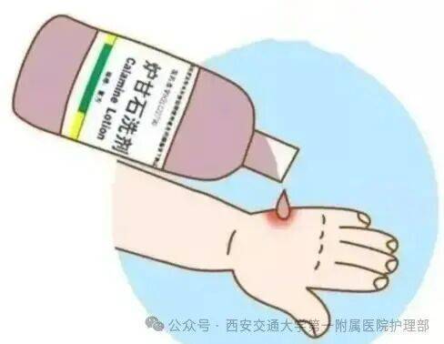 西安多区发现隐翅虫？千万别拍<strong></p>
<p>黄金原油早评</strong>！毒液堪比硫酸