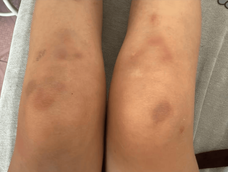 女子自称因工资问题被老板锁办公室里打 警方:双方已到派出所<strong></p>
<p>融原油</strong>,是否打人还在调查