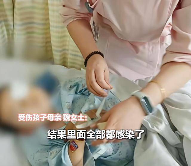 江西一5岁男孩在幼儿园被戳伤致左眼失明<strong></p>
<p>原油户</strong>,家长称老师用猪油涂抹试图消肿