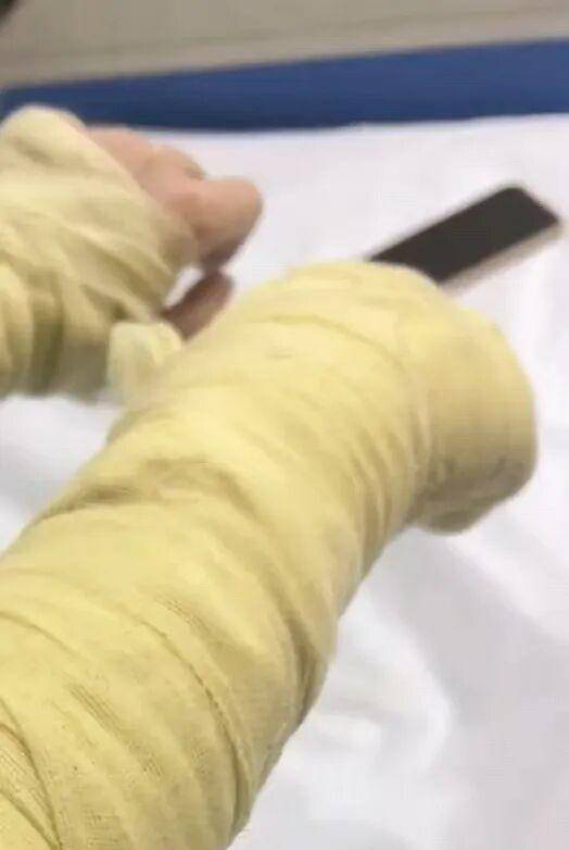 湖南一女主播被伪装的包裹炸伤<strong></p>
<p>原油今日走势</strong>，永州公安：正在核实具体情况