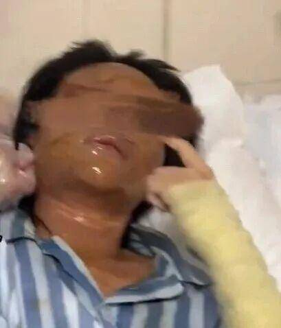 湖南一女主播被伪装的包裹炸伤<strong></p>
<p>原油今日走势</strong>，永州公安：正在核实具体情况